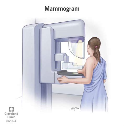 Mammogram: What It Is, Types, Purpose & Results .